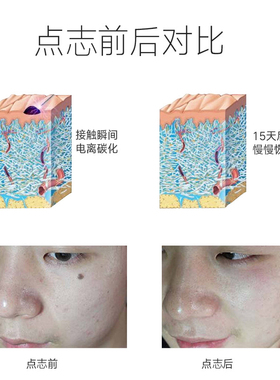 家用正品祛斑扫斑点斑机笔德国