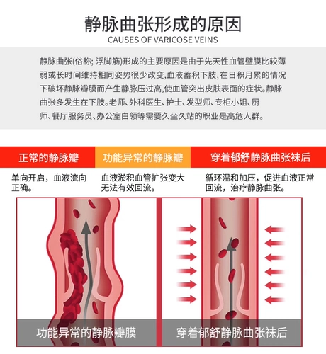 郁舒 Медицинское варикозное варикозное варикозное вены упругие чулки сжатие медицинское лечение для мужчин и женщин после операции по лимфедеме