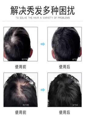 新品养发汤头疗汤精华液套盒