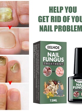 Nail Fungus Treatment Essence Serum Care Hand and Foot Care