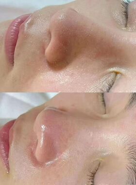 净肤清透丽颜套盒深层清洁去除黑头溶解油脂疏通毛孔细致