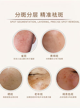 美白祛斑美肌液30ml/瓶 淡化基底层黑色素亮白祛黄断黑均匀肤色