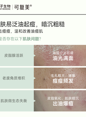 【U先定向】可复美秩序水净痘控油精华水30ml+秩序乳14ml-试用