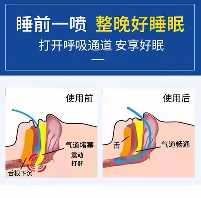 严重打呼噜【三天除鼾】快速止鼾打呼噜声音大憋气憋醒鼾立停喷剂 - 图0