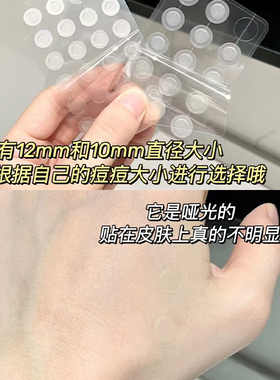 韩国欧利芙洋痘痘贴祛痘不留痕