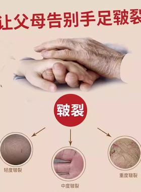 高原护肤霜藏族彝族旅游徒步少数户外保湿防裂干燥护手霜西藏户外