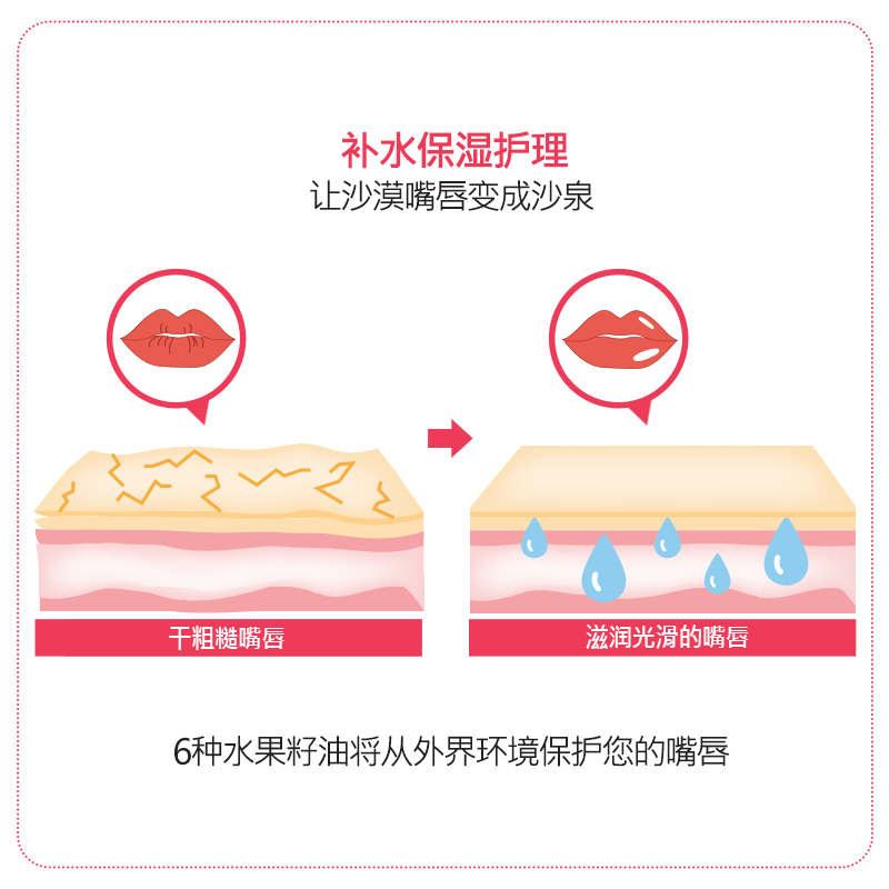 韩国直邮Frudia馥露迪雅石榴薄荷蜂蜜小蜜罐子润唇膏保湿唇膜 - 图1