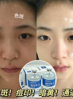 【48小时内发货】【抖音爆款】5%氨甲环酸湿敷补水精华液暗沉色素