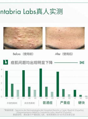 BIRETIX碧瑞可点痘凝胶祛痘