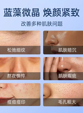 升级款蓝藻海绵微针冻干粉小绿膜海绵微晶抗皱提亮细腻毛孔