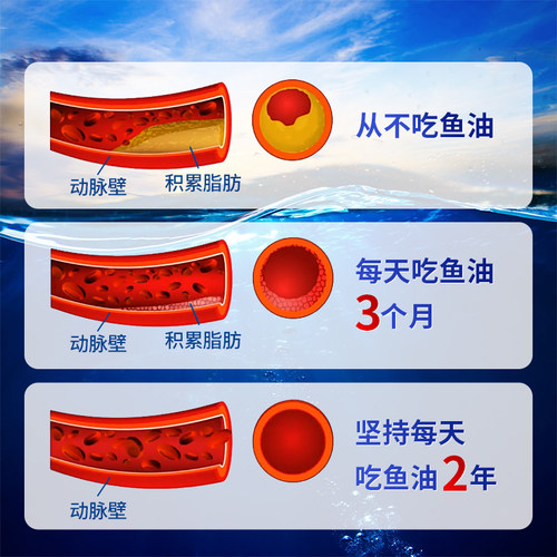 美国原装朴诺深海鱼油omega3软胶囊大人DHA欧米伽3中老年鱼肝油 - 图0