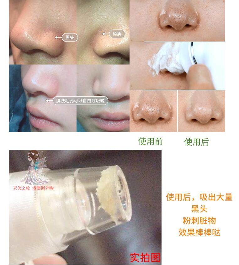 韩国Dessin吸黑头仪小气泡电动吸去黑头粉刺毛孔洁面仪美容仪神器,淘宝优惠券,粉丝福利购,淘宝优惠卷