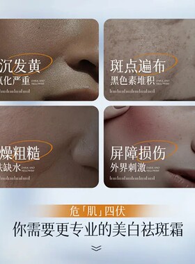 【官方正品】氨甲环酸提亮肤色瓷白改善暗沉软膏身体乳