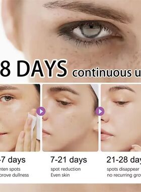 Powerful Dark Spots Remover Freckle Whitening Serum Melanin