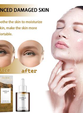 Centella Serum Nourish Improvement Dry Skin Smoothing Rejuve