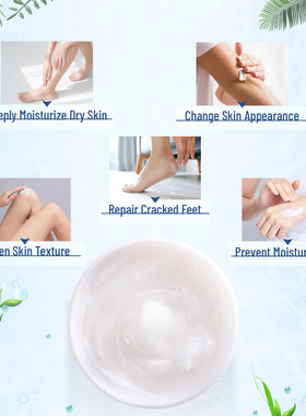 40% urea cream removing chicken skin moisturizing 40%尿素霜