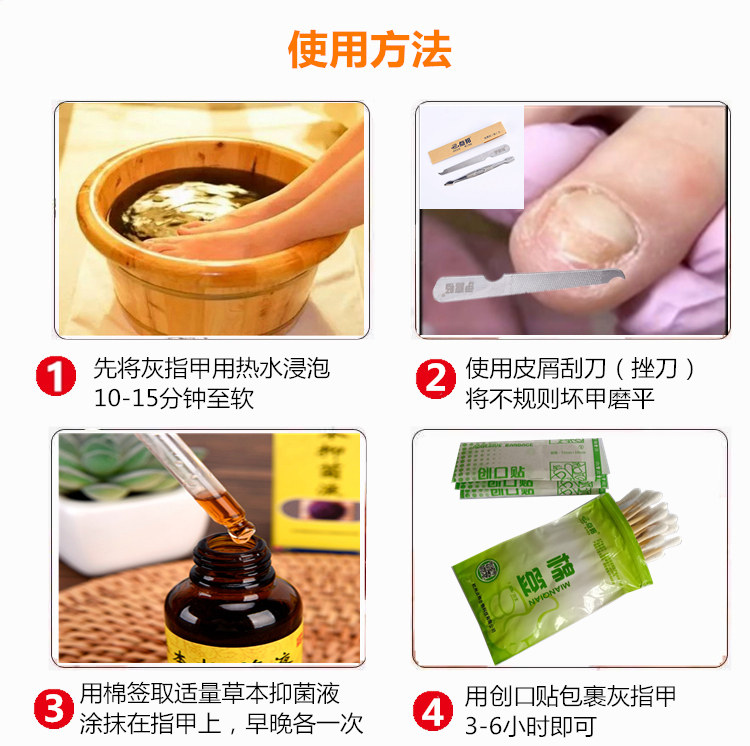 灰指甲专用液脱甲伊喜畅手指护理 熙航医疗器械保健理疗