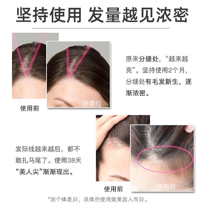 ctomi女防脱米诺地尔+精华护发素 CTOMI海外洗发水