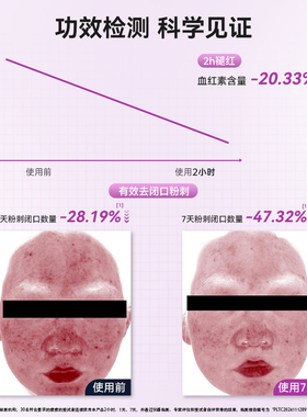 若美欣无酸焕肤精华液
