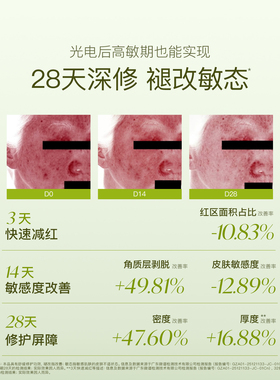 【双11预售付定】天露芬舒缓修护精华油祛痘面部护肤精华小绿瓶