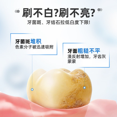【U先入仓】云南白药牙膏光钻白PRO牙膏25g 美白护龈去渍 - 图2