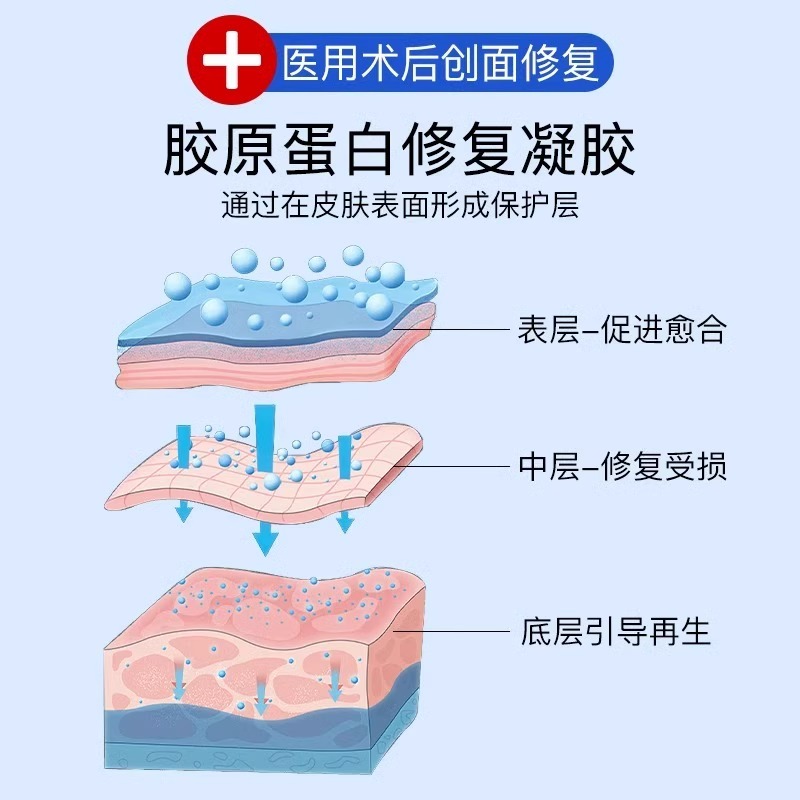 医用重组人表皮因子生长凝胶型皮肤修复外伤手术伤口消炎愈合贴外 - 图1