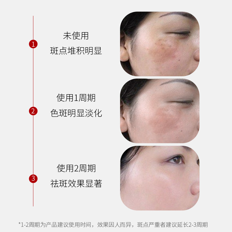 肤妍美白祛斑霜黄褐斑氢醌霜烟酰胺 海雅化妆品乳液/面霜