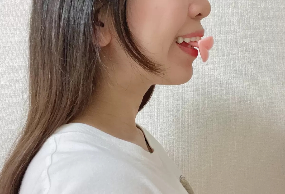 日本微笑矫正器训练笑容神器脸部肌肉锻炼口型嘴唇形练习嘴角上扬 - 图1