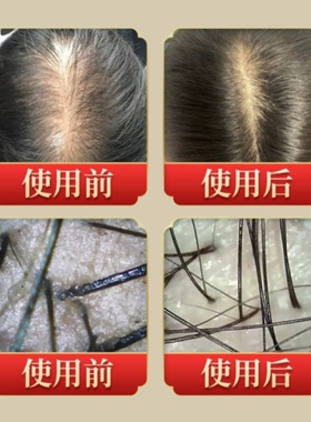 纯天然手工皂【拆用可退】洗发皂