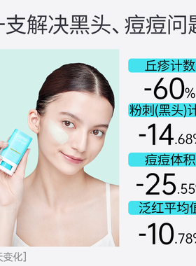 护妍天使控油祛痘泥膜棒