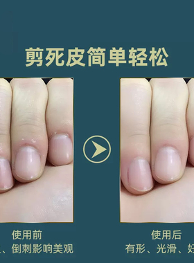 张小泉专业脚趾甲死皮剪