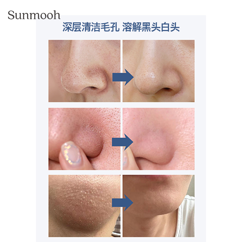 【Sunmooh】温感溶解去黑头BProject酵素啫喱导出液深层清洁毛孔-图1