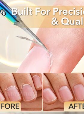 Stainless Steel Cuticle Scissors Dead Skin Remover For Nails