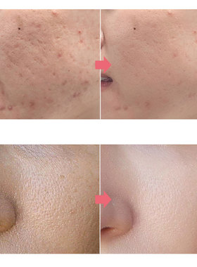 Green Tea Oil Control Pore Shrink Face Serum Whitening Remov
