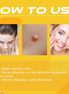 Revitalize Your Skin With Ximonth Bee Venom Spray For Wart