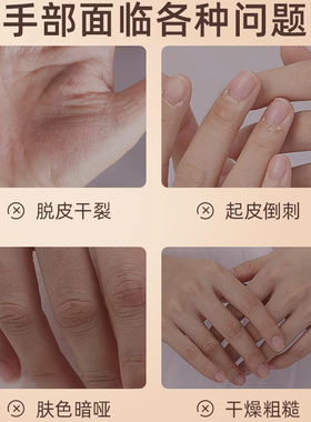 到手3支！隆力奇蛇油护手霜套装