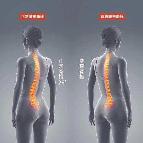 德国腰椎舒缓器腰部顶腰板拉伸按摩伸展器脊椎矫正瑜伽开背辅助器 - 图2