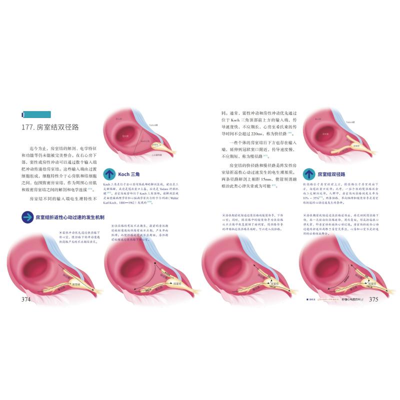 秒懂心电图百科全彩医学插画本魏希进,杜建霖,钟舒编临床医学生活新华书店正版图书籍化学工业出版社-图2