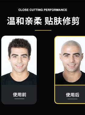 Shaving head artifact self-scraping Special men's electric