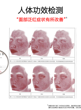 九妍皮肤屏障修护霜护肤保湿面霜薄弱肌修护厚皮霜
