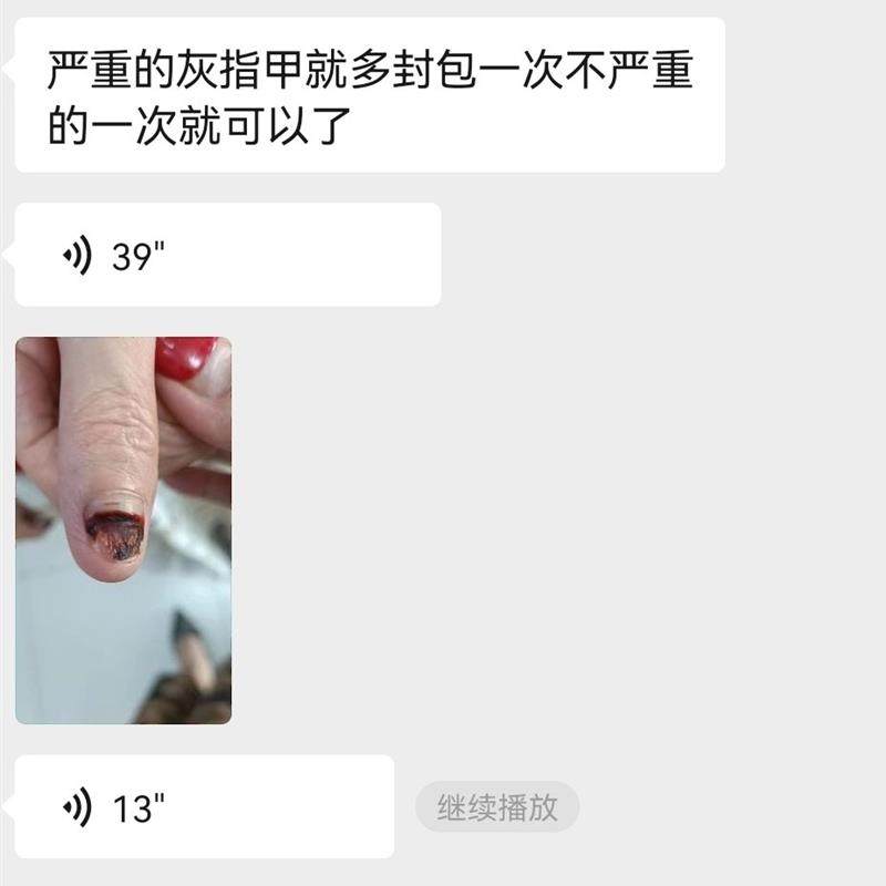 灰甲脱甲膏灰甲只需要包就可以好后期不需要用药护理省心省事简单,淘宝优惠券,粉丝福利购,淘宝优惠卷