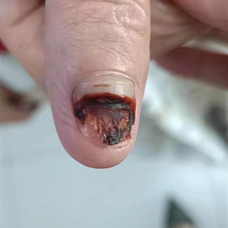 灰甲脱甲膏灰甲只需要包就可以好后期不需要用药护理省心省事简单,淘宝优惠券,粉丝福利购,淘宝优惠卷