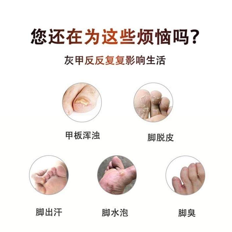 足太公护理液气臭脱皮水泡痒干灰指甲各种真6袋为1疗程 买3送1,淘宝优惠券,粉丝福利购,淘宝优惠卷