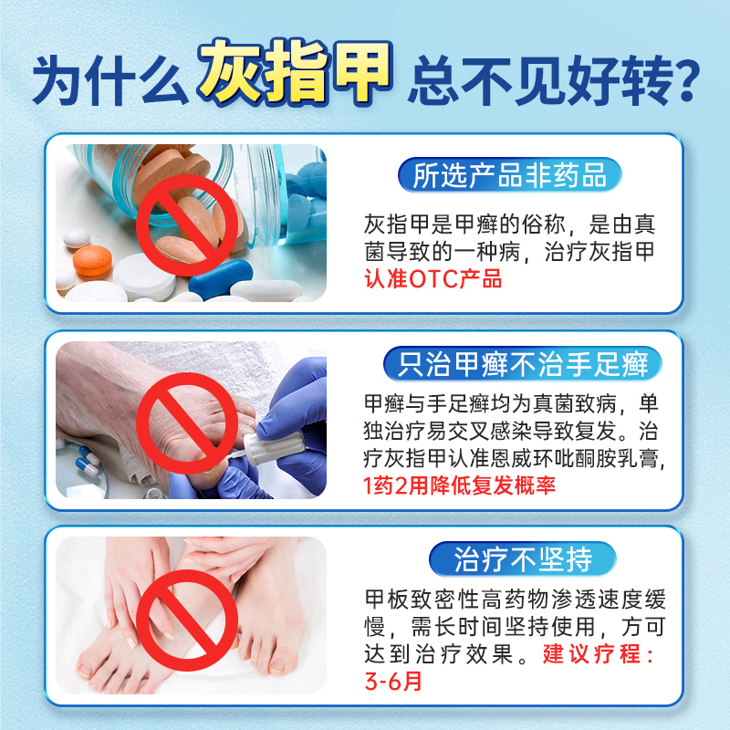  恩威癣症