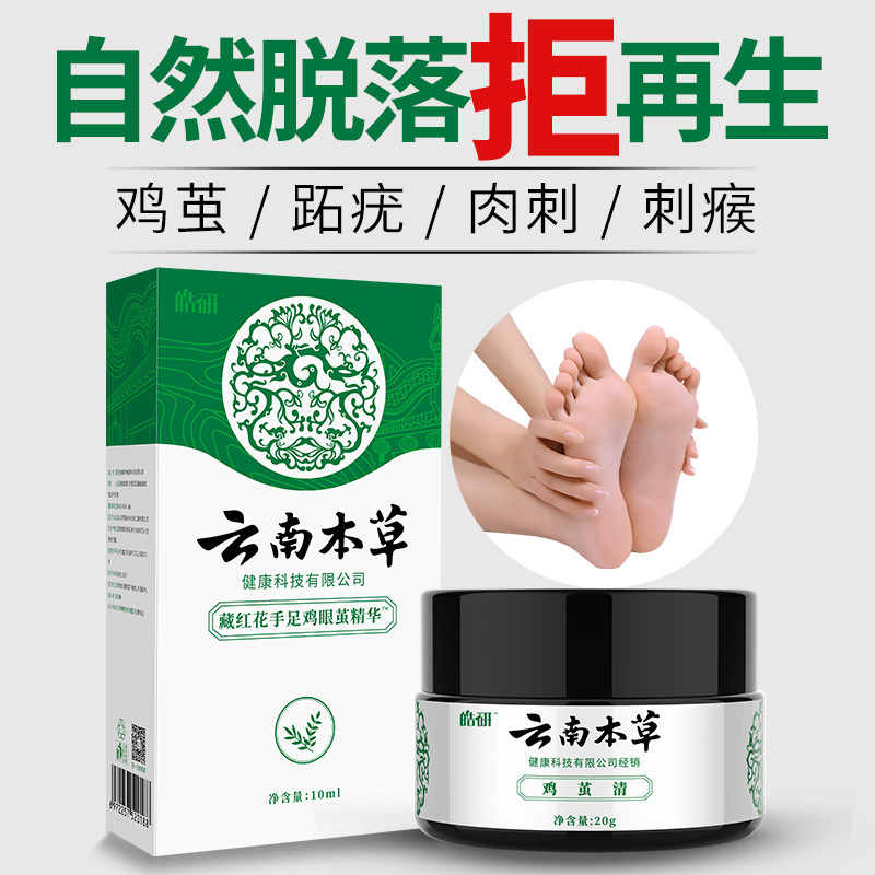?跖疣膏去除手足部根扁平疣鸡眼贴 皓研复吉针灸器具（器械）
