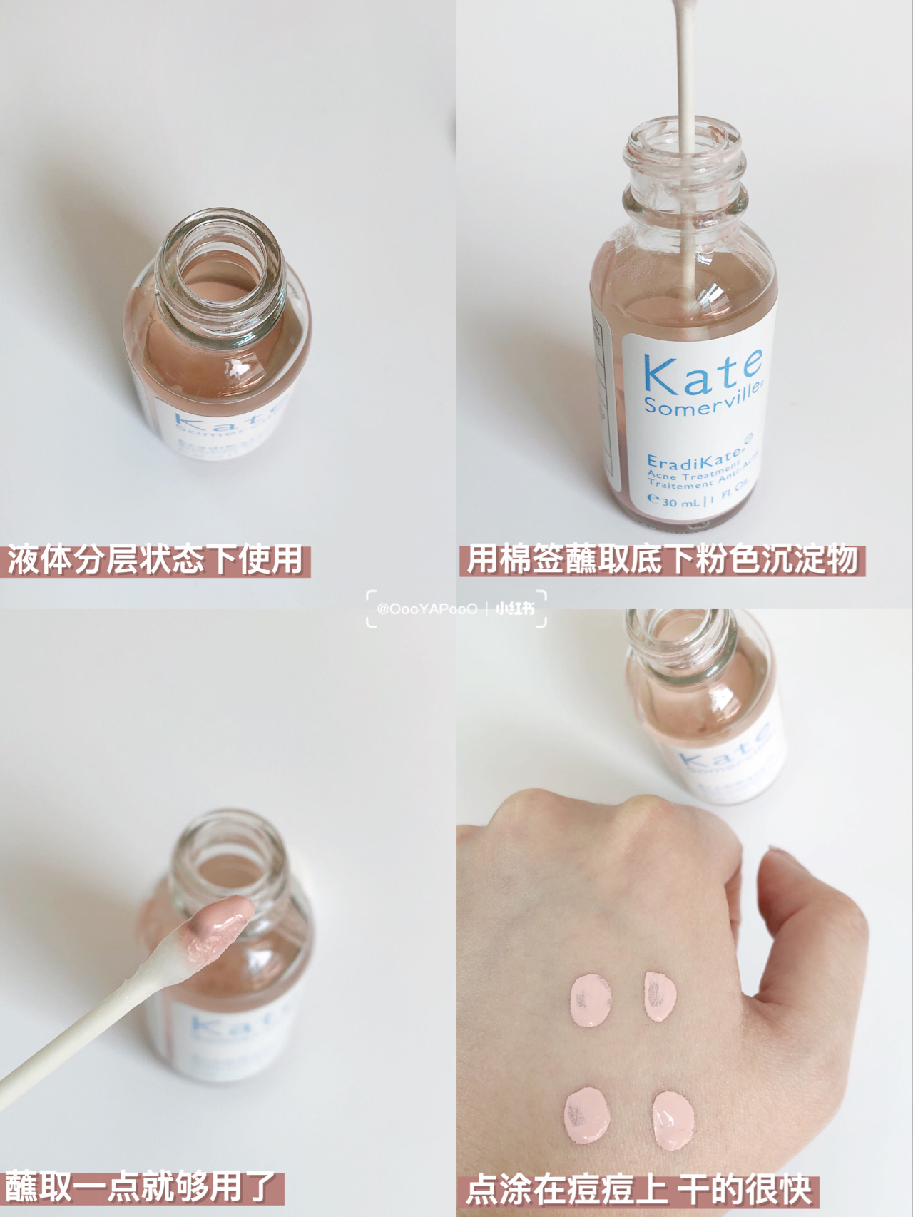 骨折价！Kate Somerville凯诗薇小粉瓶祛痘精华 ks祛痘水 30ml-图2