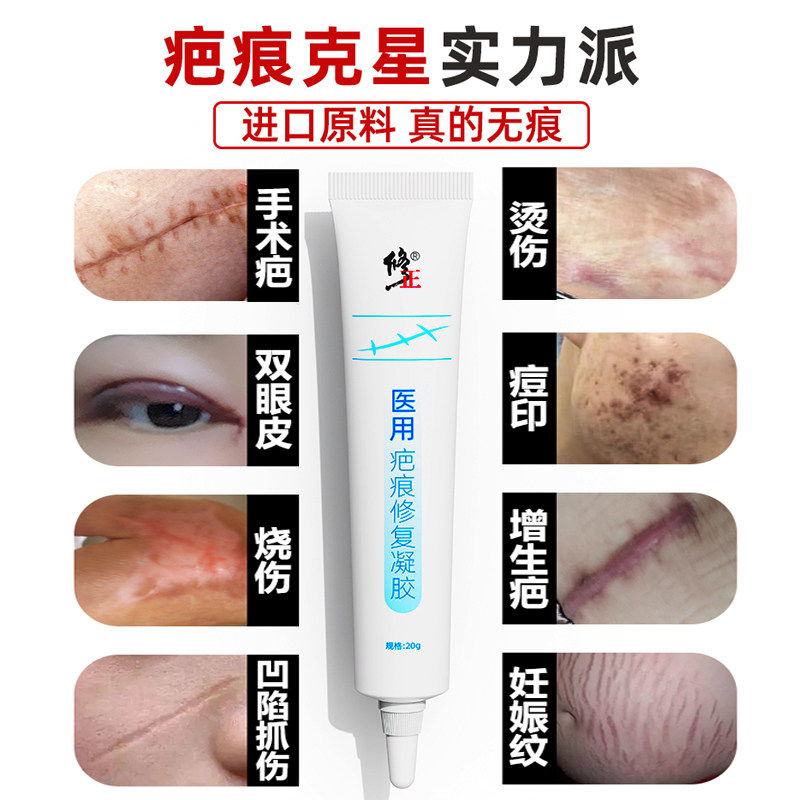 祛疤膏疤印黑色素沉淀医用儿童疤痕修复膏去小孩除疤专用去除痘印