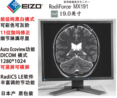 CR/CT医用显示器医疗EIZO艺卓灰阶黑白S1923/S1933/MX191/MX193 - 图2