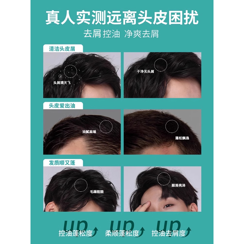 洗发水男去屑止痒控油蓬松男士专用洗头膏沐浴露套装正品官方品牌