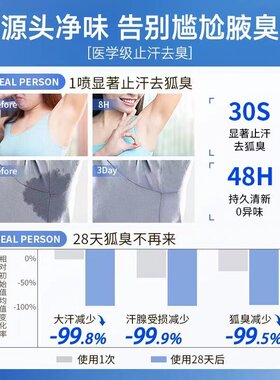 仁和药业腋下喷雾止汗香体露30g